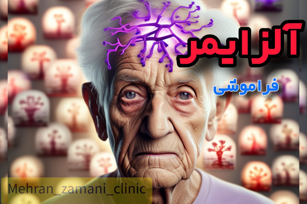 آلزایمر، بیماری یا معضل قرن